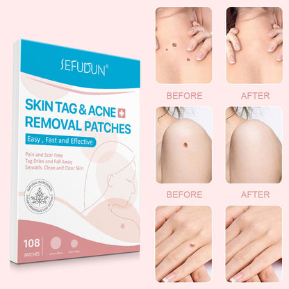 Acne Skin Tag Remover Beauty Acne Patch Wart Removal Stickers Removal Care Invisible Blackhead Skin Patch