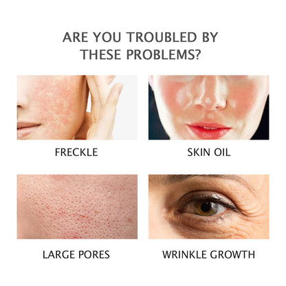 Hydrating And Oil Controlling Nourishing Skin Moisturizing Repair Cream