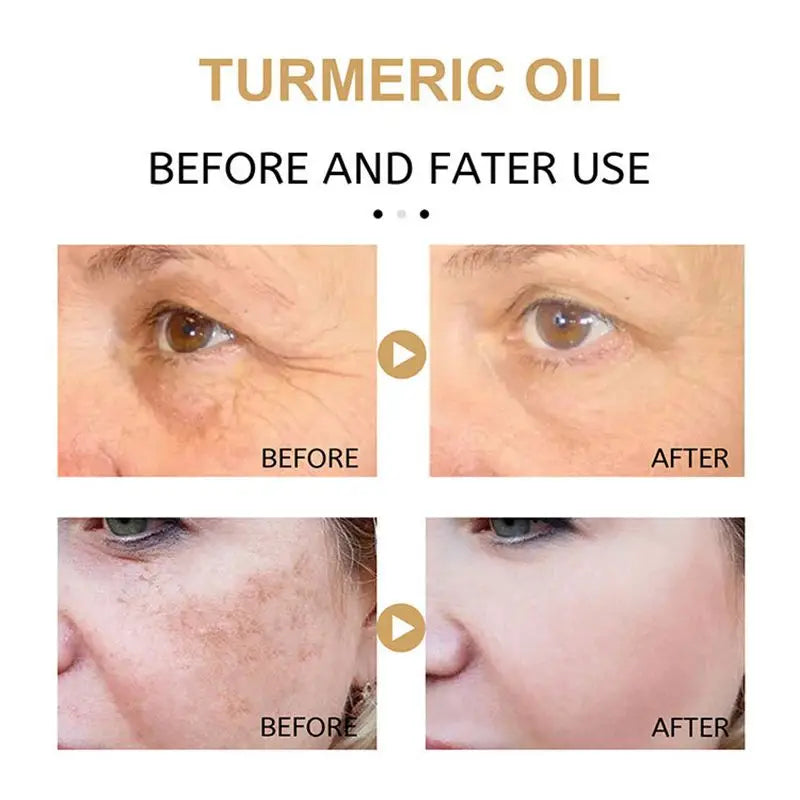 Dark Spot Fade Serum 30ml