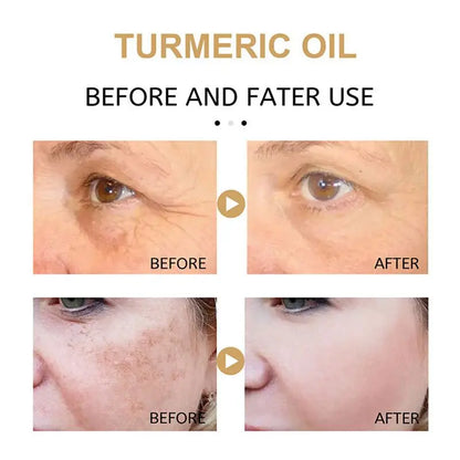 Dark Spot Fade Serum 30ml