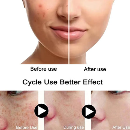 Dark Spot Fade Serum 30ml