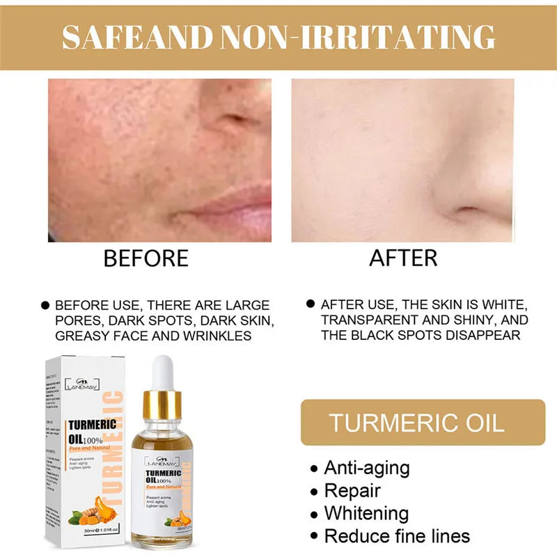 Dark Spot Fade Serum 30ml