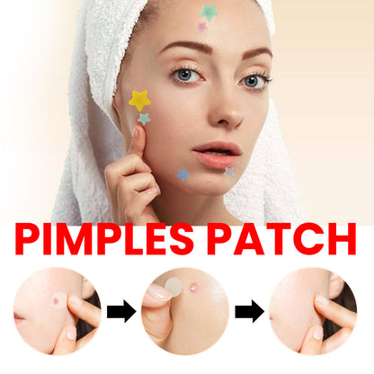 Pimple Patches, Pimple Patches For Face, Hydrocolloid Acne Patches, Cute Star Stickers Hydrocolloid Acne Pimple Patch For Covering Zits And Blemishes