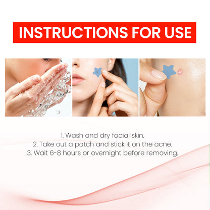 Pimple Patches, Pimple Patches For Face, Hydrocolloid Acne Patches, Cute Star Stickers Hydrocolloid Acne Pimple Patch For Covering Zits And Blemishes
