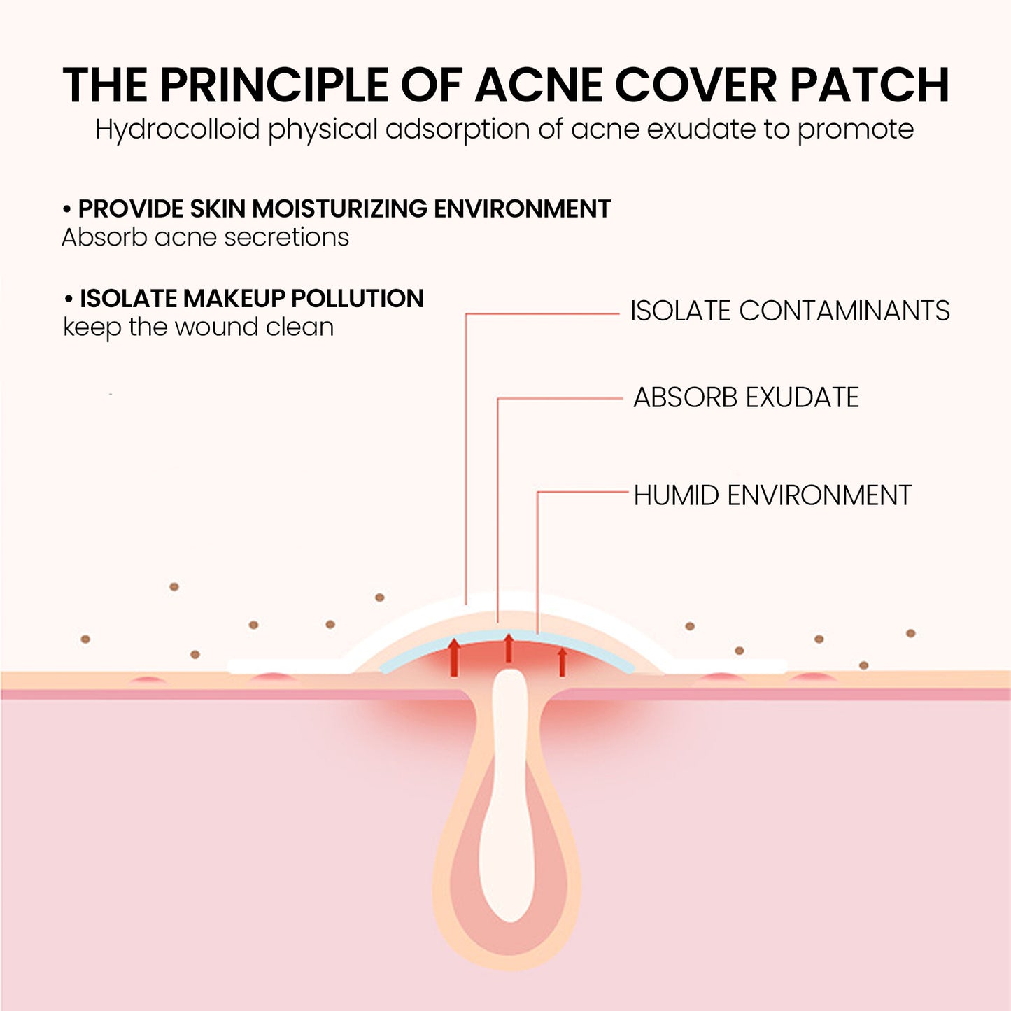 Pimple Patches, Pimple Patches For Face, Hydrocolloid Acne Patches, Cute Star Stickers Hydrocolloid Acne Pimple Patch For Covering Zits And Blemishes
