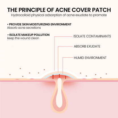 Pimple Patches, Pimple Patches For Face, Hydrocolloid Acne Patches, Cute Star Stickers Hydrocolloid Acne Pimple Patch For Covering Zits And Blemishes