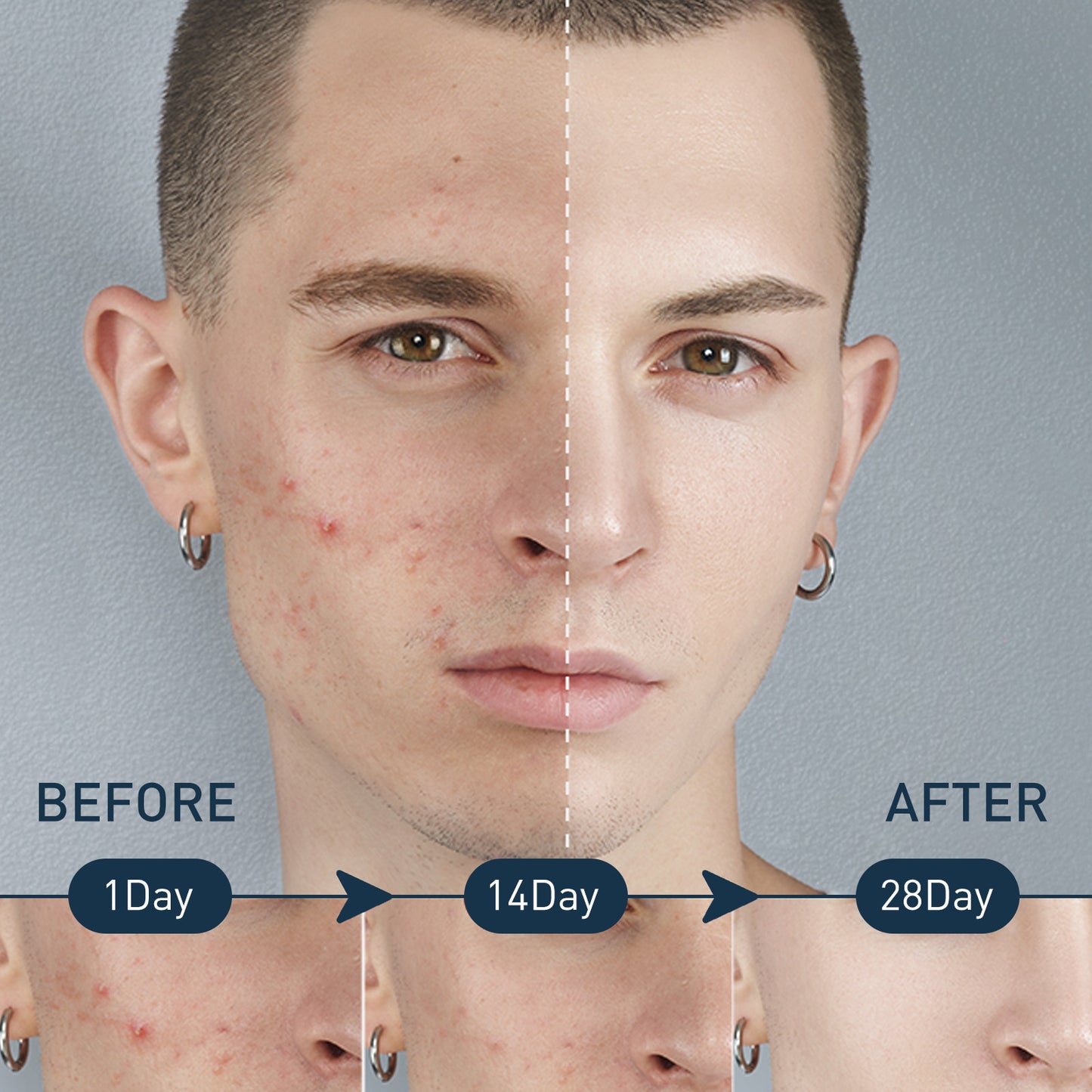 Men's Exfoliating Mousse Mild Skin Cleaning Acne Removing Shrink Pores Oil Control